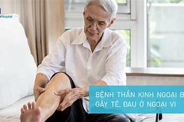 Bệnh Thần Kinh Toạ Tiếng Anh Là Gì